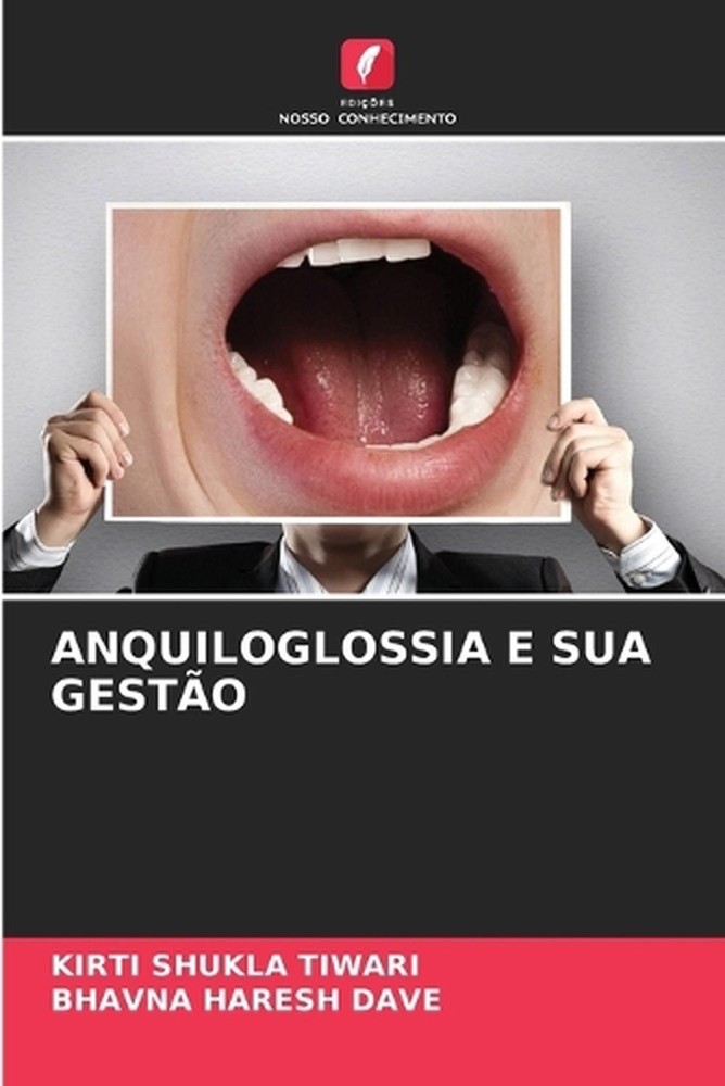 Anquiloglossia E Sua Gesto by Kirti Shukla Tiwari (Portuguese) Paperback Book