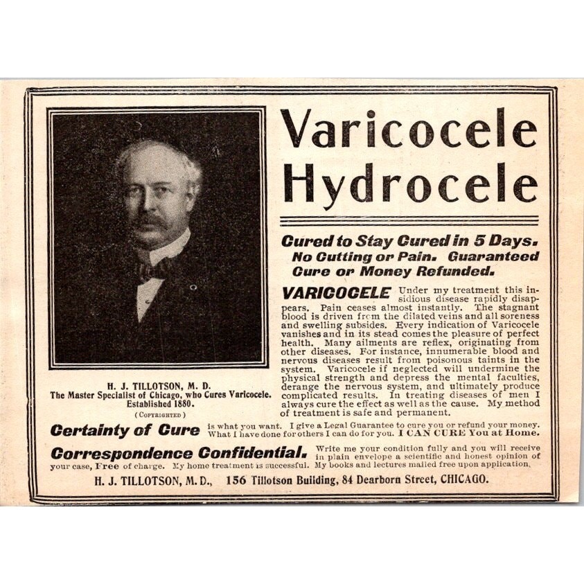 Varicocele Hydrocele Certainty Of Cure H Tillotson Chicago 1902 Clipping SAI4-H3