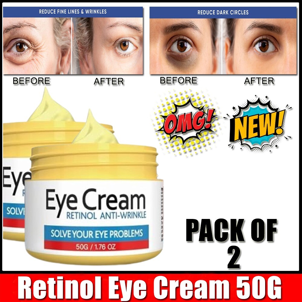 Retinol Eye Cream for Dark Circles Wrinkles & Puffiness 1.7 oz