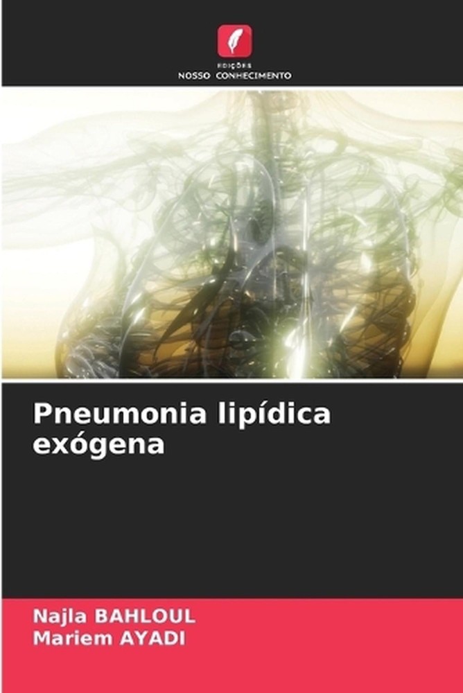 Pneumonia lipdica exgena by Najla Bahloul (Portuguese) Paperback Book