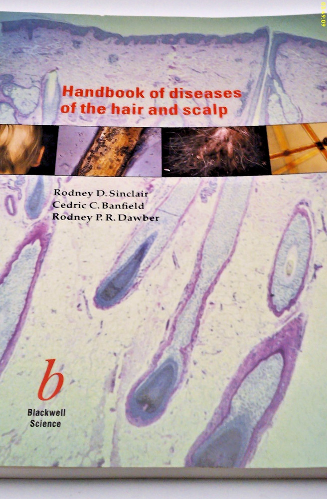 Handbook of Diseases of the Hair and Scalp by Rodney Sinclair, Rodney P. R....