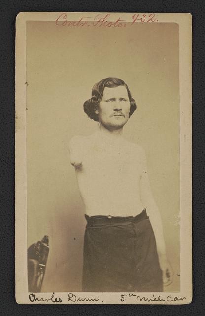 Photo:Charles Dunn 5th Michigan Cavalry 1865 Amputee Soldier Portrait