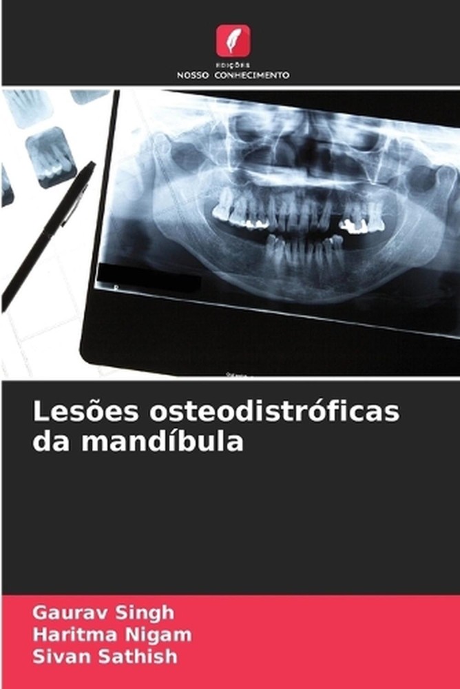 Leses osteodistrficas da mandbula by Gaurav Singh (Portuguese) Paperback Book