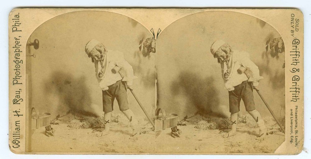 B5613~ Crippled Young Boy Stereoview with Crutch – by W Rau Philadelphia PA
