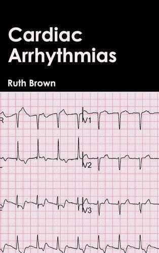 Cardiac Arrhythmias (Hardback)