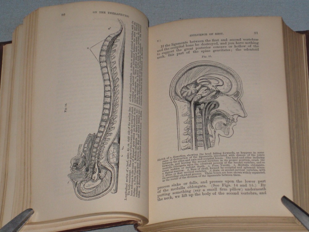 1877 Book Lectures On Rest And Pain By John Hilton