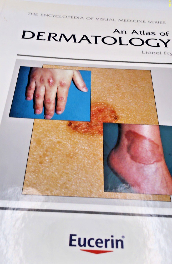 An Atlas of Dermatology -Encyclopedia of Visual Medicine Series L.Fry