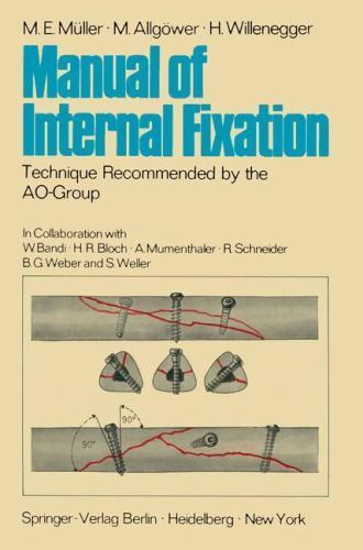 Manual of Internal Fixation : Technique Recommended by the Aogroup Swiss Asso...