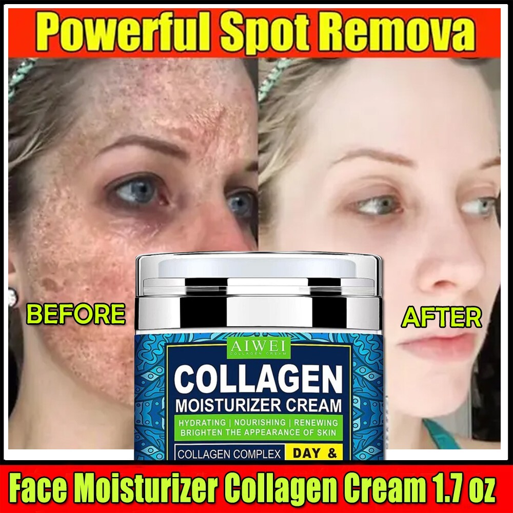 Collagen Anti-aging Cream for Face - 100% Pure Medical Formula - 1.7 fl oz