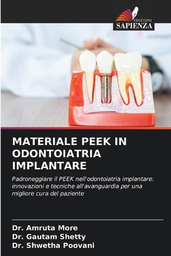 Materiale Peek in Odontoiatria Implantare by Dr Amruta More (Italian) Paperback