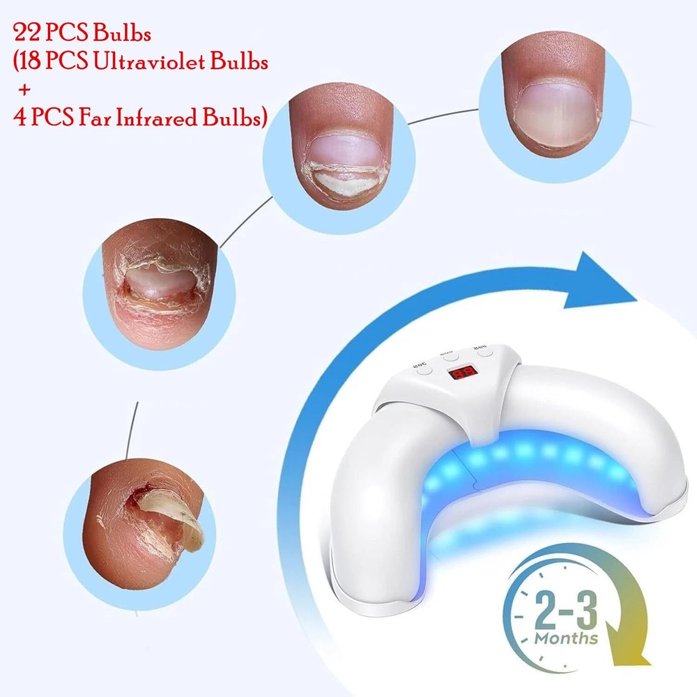 Nail Fungus UV Nail Lamp LED Light Treatment Device for Toenails & Fingernails