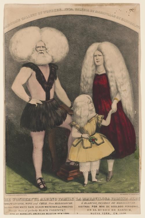 The wonderful albino family / la maravilosa familia albi historic photo