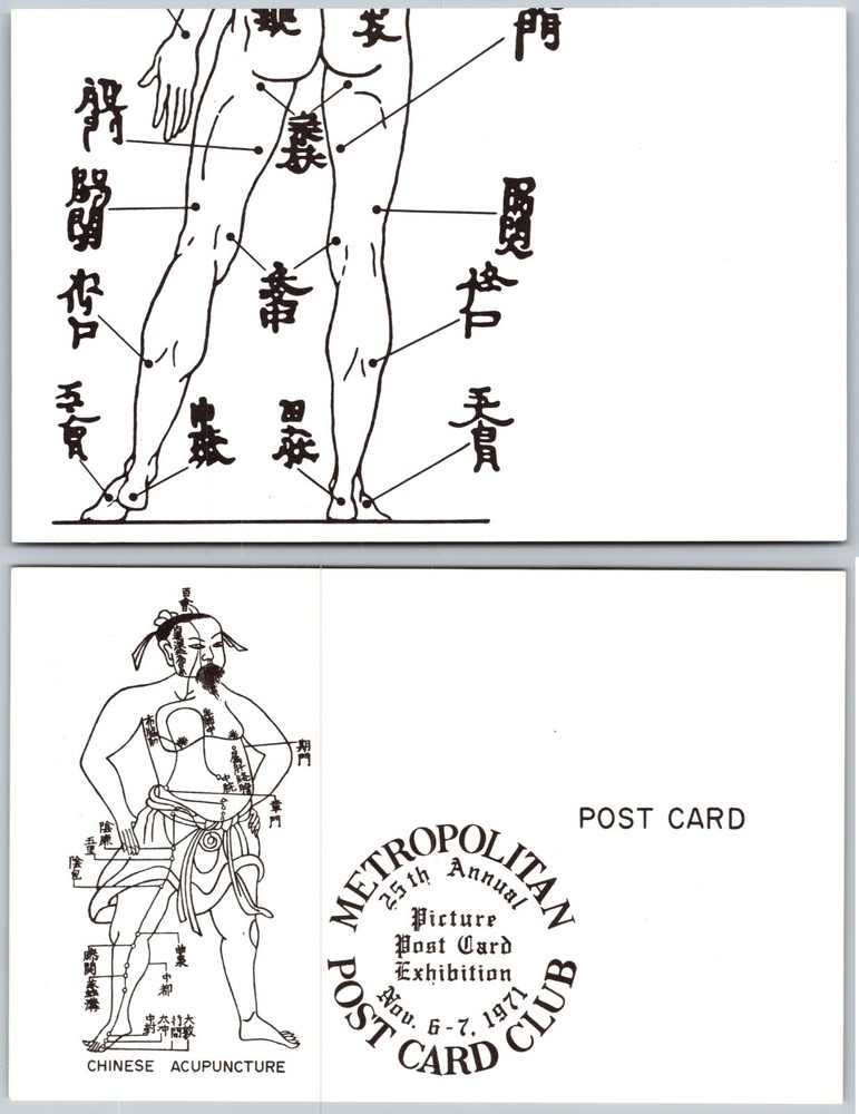 Chinese Acupuncture Diagram Postcard