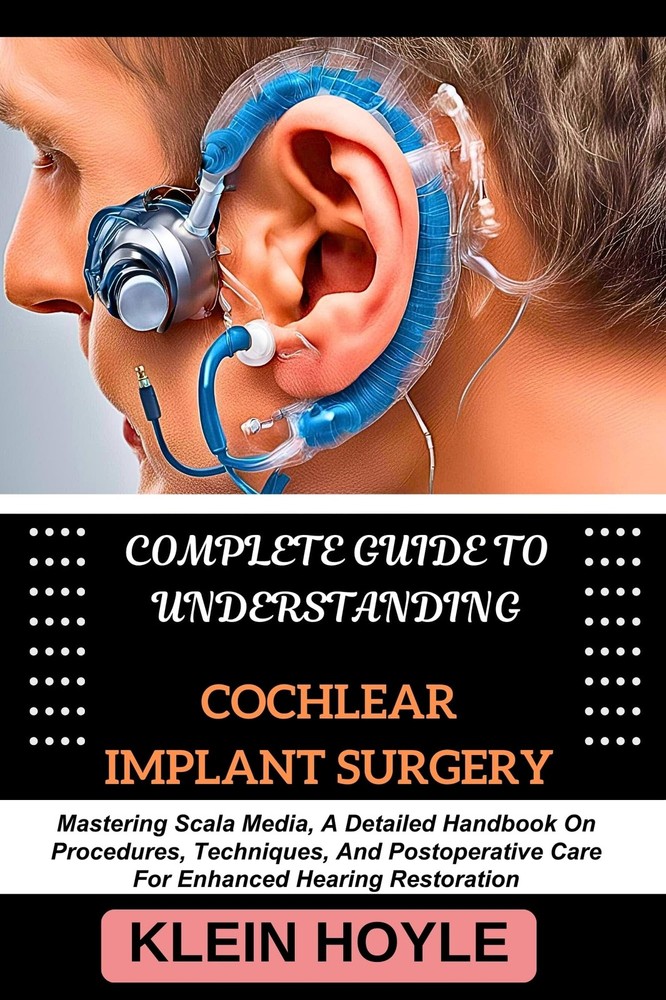 Klein Hoyle Complete Guide to Understanding Cochlear Implant Surgery (Paperback)Another great item from Rarewaves USA | Free delivery!
