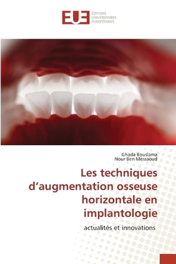Les techniques d'augmentation osseuse horizontale en implantologie by Ghada Bous