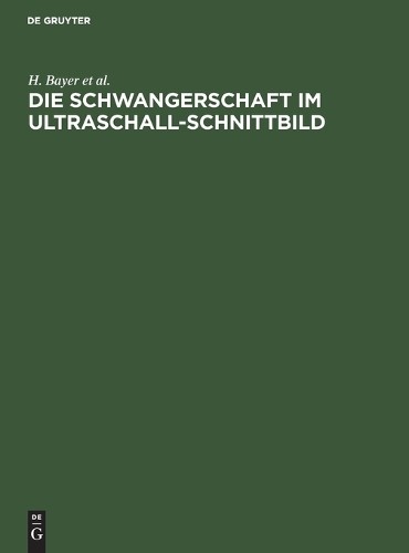 H Bayer R Schulte P Prenzlau  Die Schwangerschaft Im Ultraschall-Schn (Hardback)