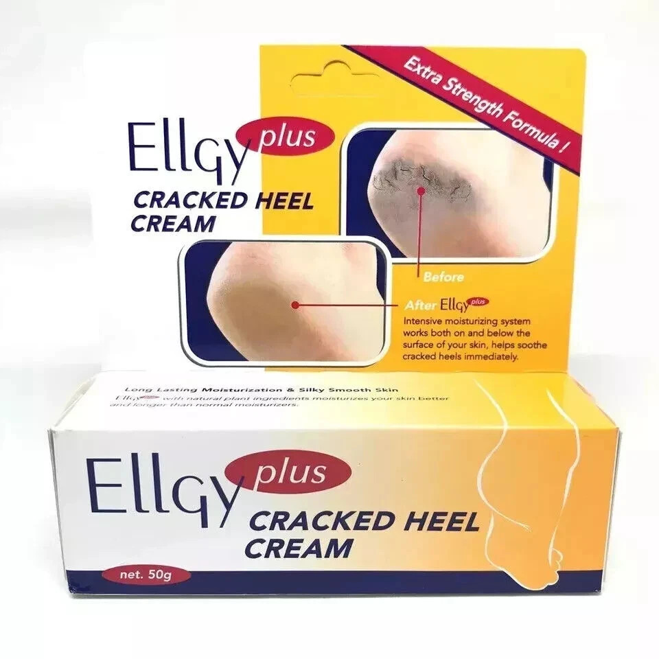 ELLGY Plus Cracked Heel Cream 50g – Pack of 1 or 2 with Free Global Shipping