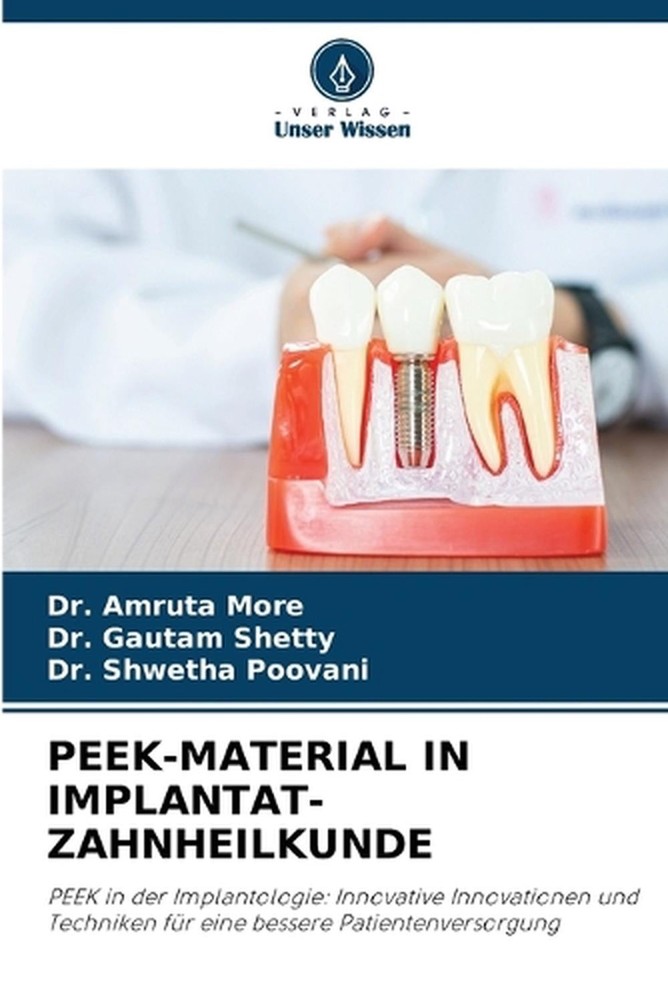 Peek-Material in Implantat-Zahnheilkunde by Dr Amruta More (German) Paperback Bo
