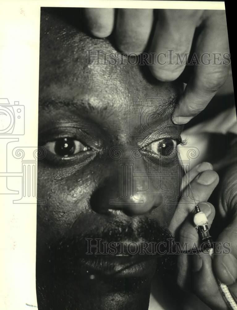 1984 Press Photo Dr. Robert Balkan and Patient Lawrence Perry, New Orleans