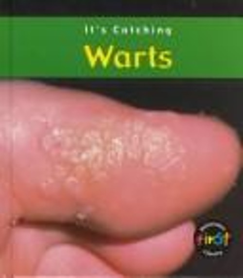 Warts Library Binding Angela RoystonFree US Delivery | ISBN:1588102319