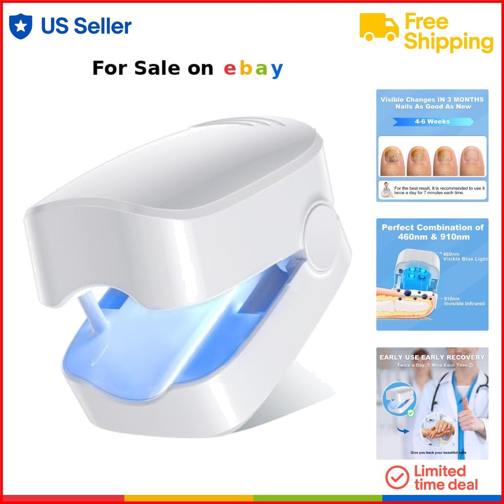 Portable Blue Light Laser Device for Pain-Free Nail Fungus Treatment at Home