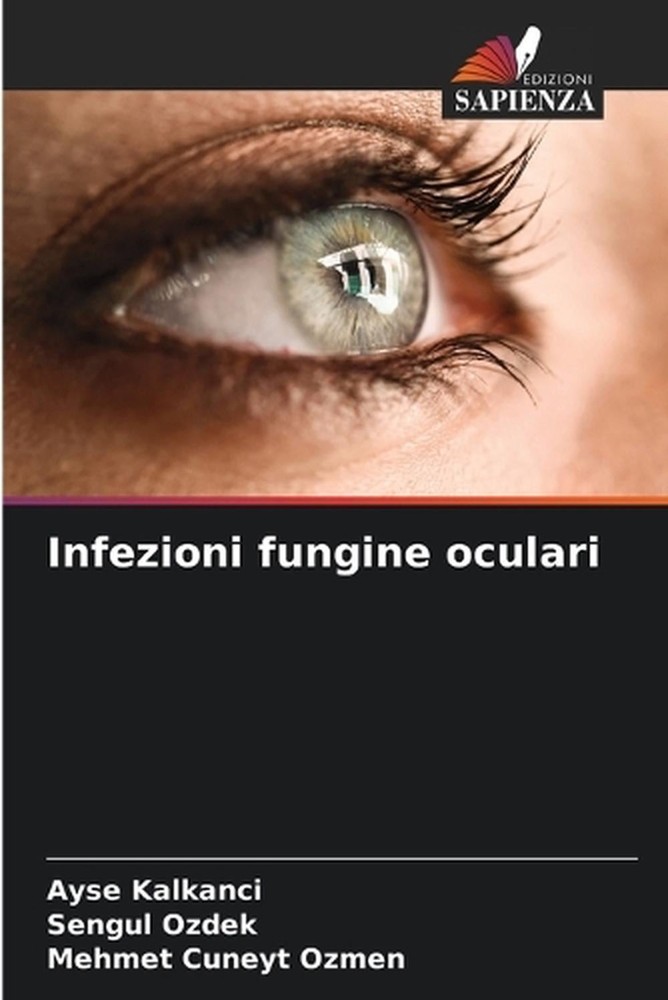 Infezioni fungine oculari by Ayse Kalkanci (Italian) Paperback Book