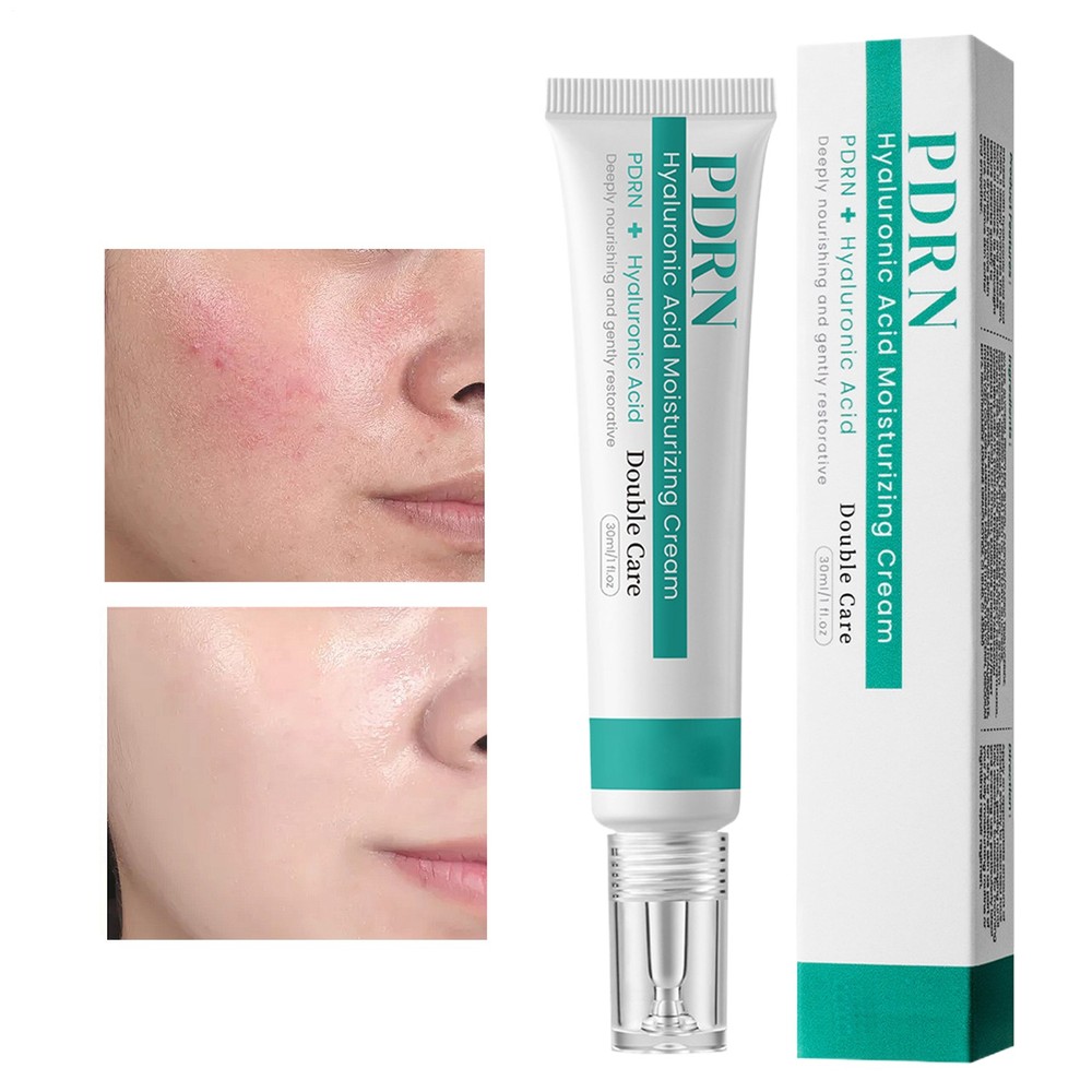 Anua PDRN Hyaluronic Acid 100 Moisturizing Cream