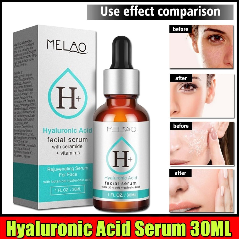 Hyaluronic Acid Vitamin C Anti-Aging Wrinkle Serum Cream 1 oz