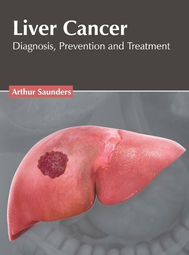 Liver Cancer: Diagnosis, Prevention and Treatment (Hardback)