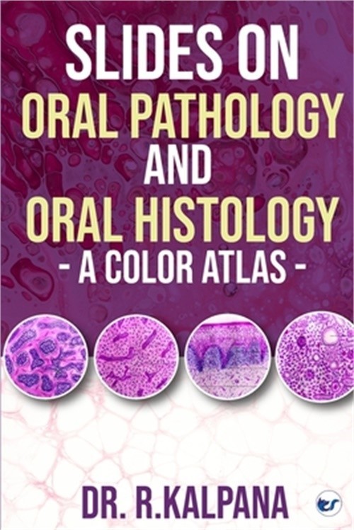 Slides on Oral Pathology and Oral Histology - A Color Atlas (Paperback or Softba