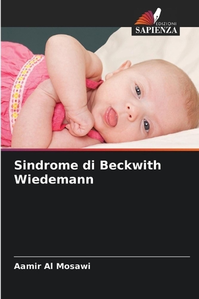 Sindrome di Beckwith Wiedemann by Aamir Al Mosawi (Italian) Paperback Book