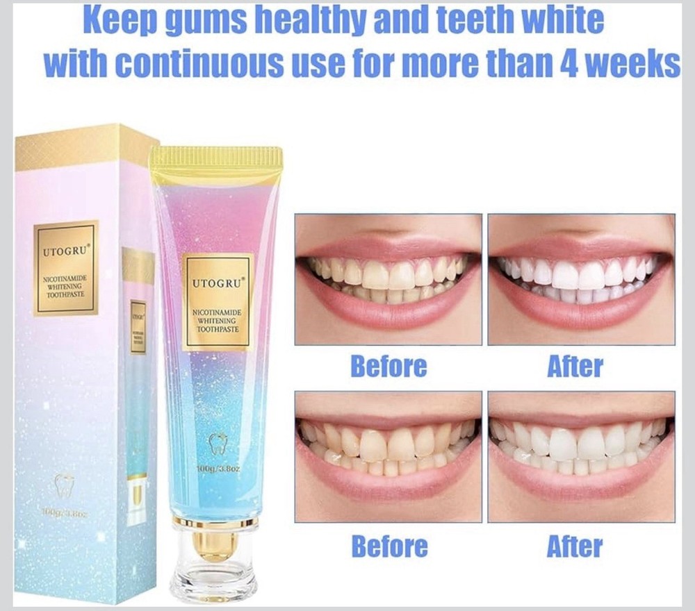 New Niacinamide Whitening Toothpaste, Utogru Teeth Radiant Whitening Toothpaste