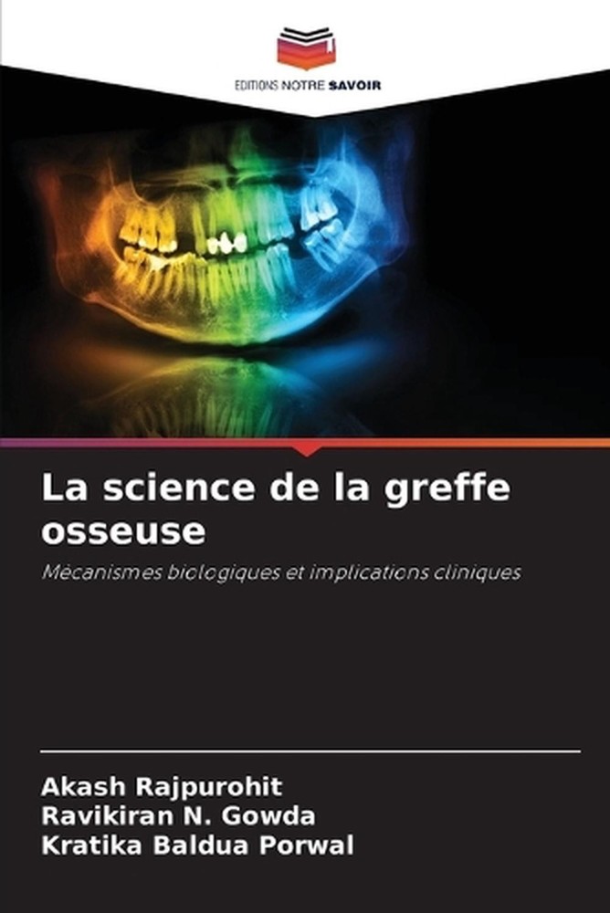 La science de la greffe osseuse by Akash Rajpurohit (French) Paperback Book