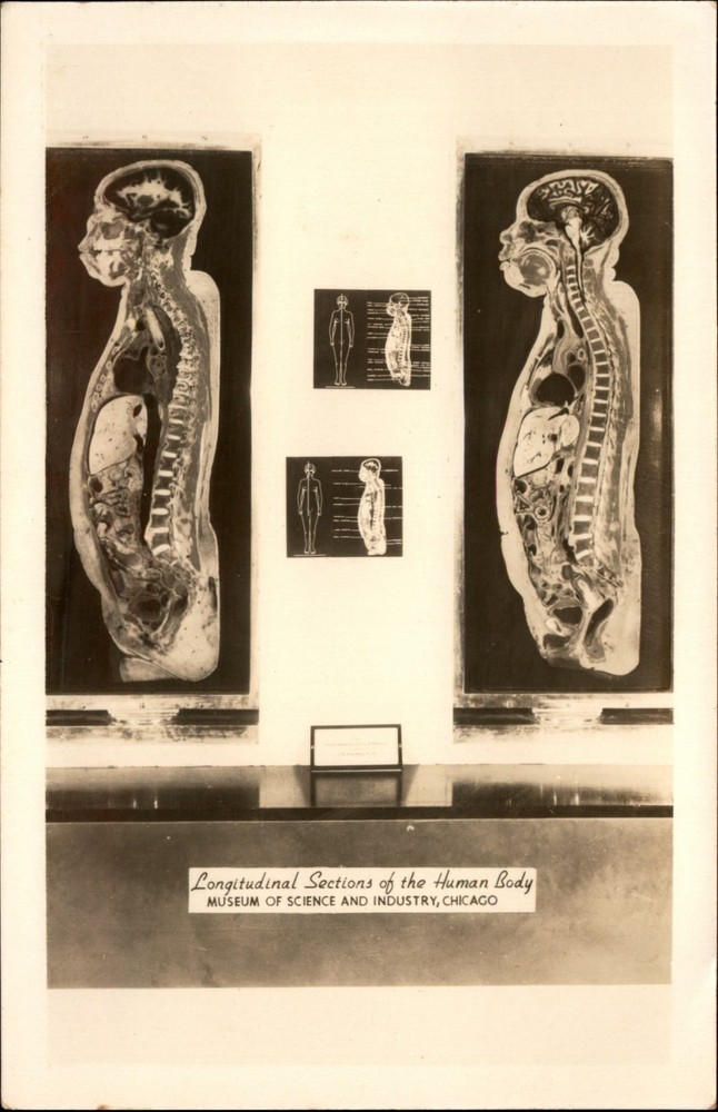 RPPC Human Body Museum of Science and Industry Chicago vintage postcard u878