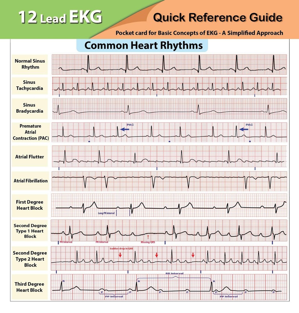 12 Lead EKG Pocket Card 4.25'' x 5.5'', Unspecified