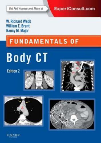 Fundamentals of Body CT (Fundamentals of Radiology), USED-Acceptable, Webb MD, W