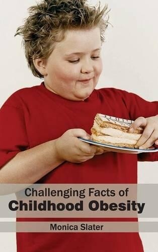 Challenging Facts of Childhood Obesity (Hardback)