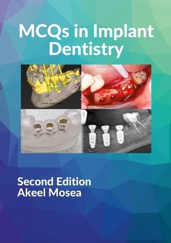 Akeel Mosea MCQS in Implant Dentistry (Paperback)Another great item from Rarewaves USA | Free delivery!