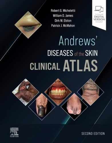 Andrews' Diseases of the Skin - Hardcover, by Micheletti MD Robert - New