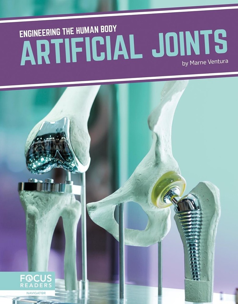 Artificial Joints by Marne Ventura (English) Paperback Book