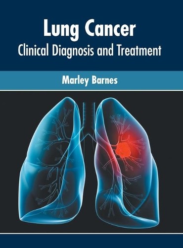 Lung Cancer: Clinical Diagnosis and Treatment (Hardback)