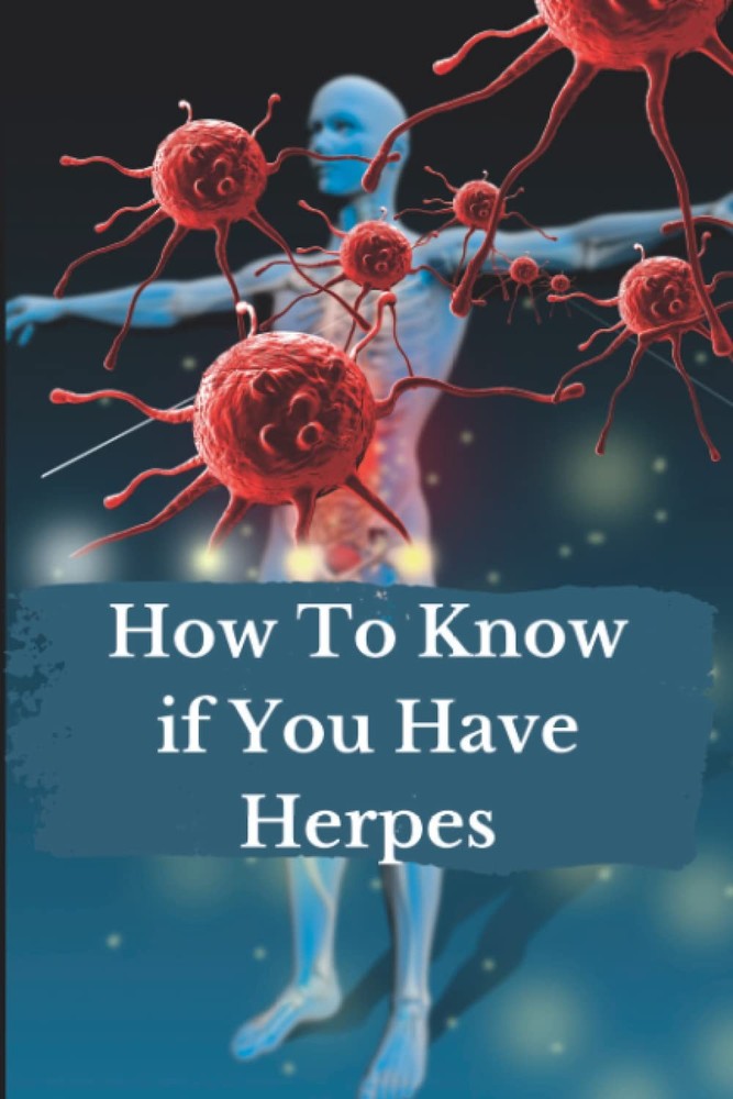 How To Know if You Have Herpes: Joke Book Cover! Weird Funny White Elephant or D