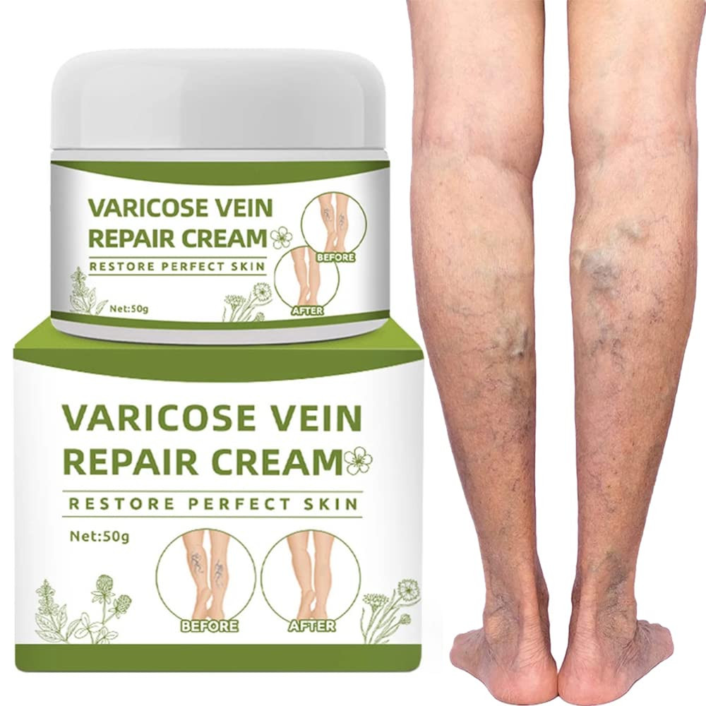 Varicose and Spider Vein Repair Cream for Leg Circulation Support