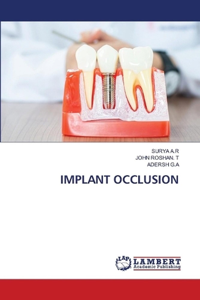 Implant Occlusion by Surya A.R. Paperback Book