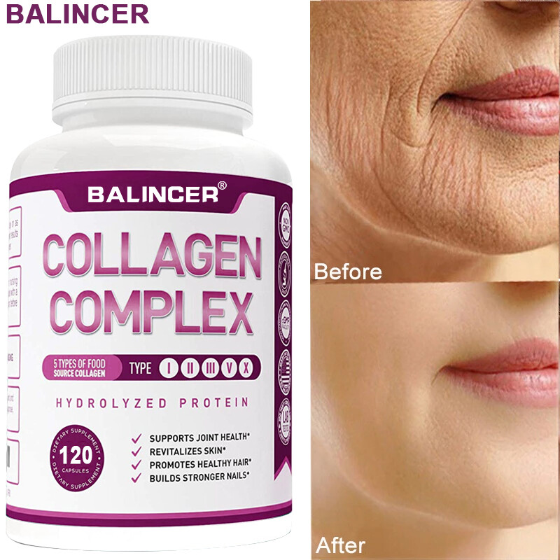 Collagen Complex 1500mg- Type I, II, III, V, X - Anti-Aging, Hydrolyzed Collagen