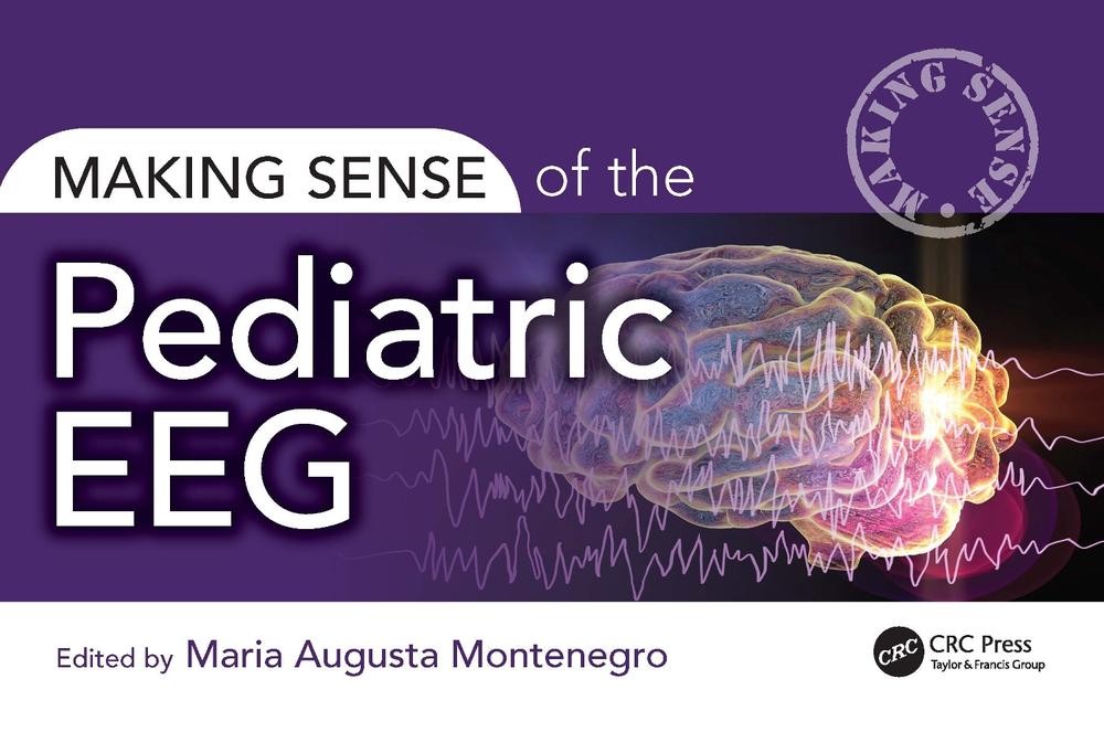 Making Sense of the Pediatric EEG by Maria Montenegro Paperback Book