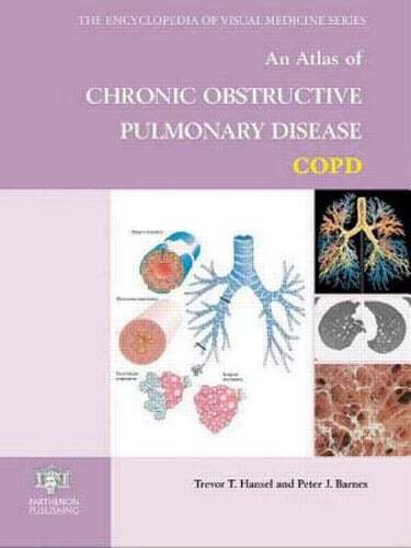 An Atlas of Chronic Obstructive Pulmonary Disease by Trevor T Hansel: Used