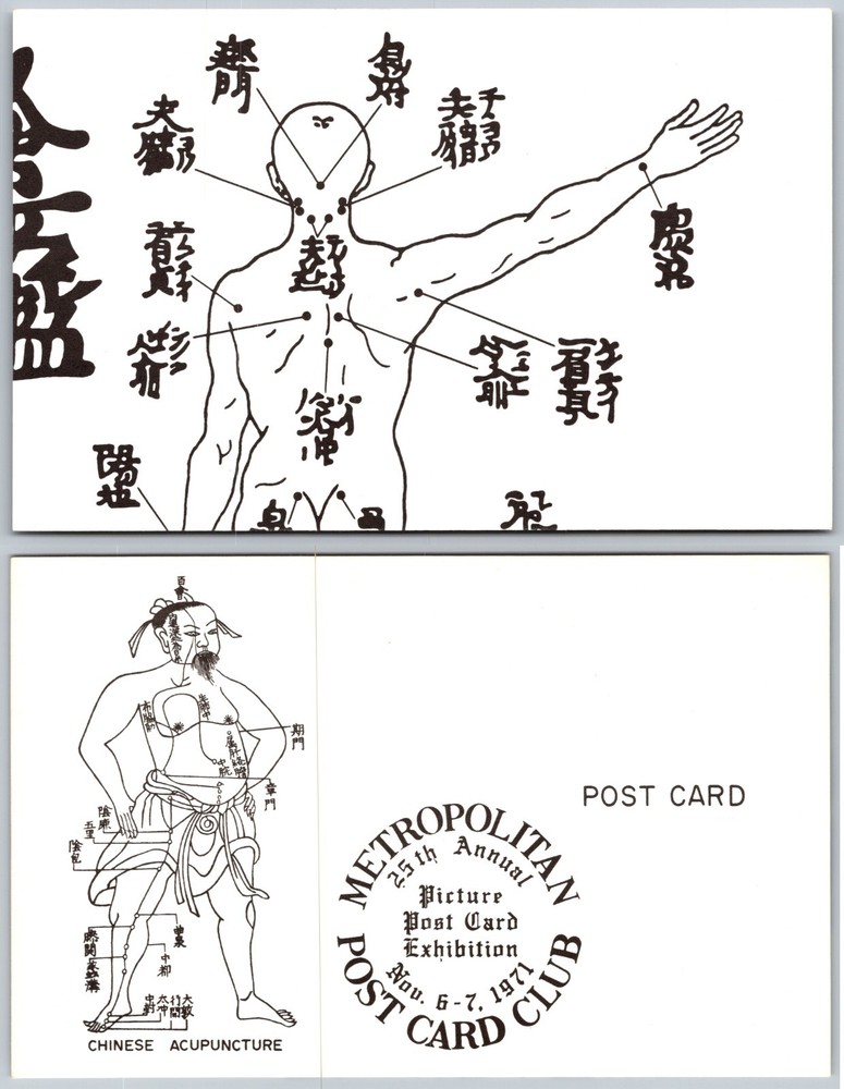 Chinese Acupuncture Diagram Postcard