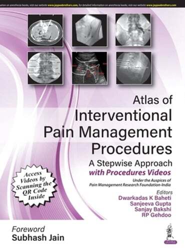 Atlas of Interventional Pain Management Procedures: A Stepwise Approach: Used