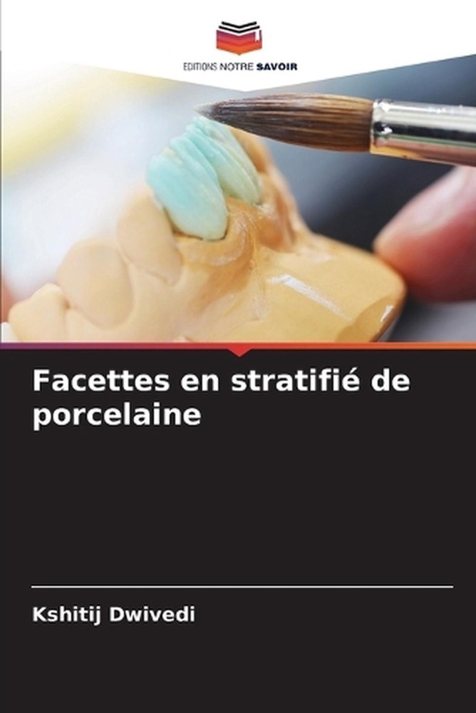 Facettes en stratifi de porcelaine by Kshitij Dwivedi (French) Paperback Book